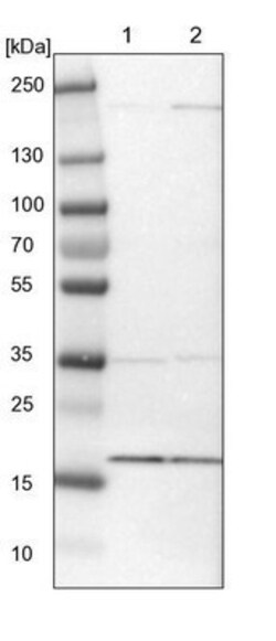 MRPL52 Antibody, Novus Biologicals:Antibodies:Primary Antibodies