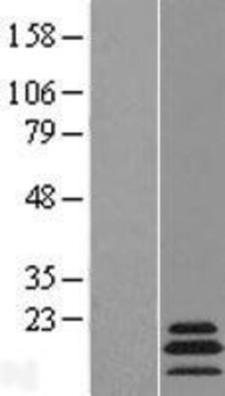 Novus Biologicals&trade;&nbsp;MRPL54 Overexpression Lysate
