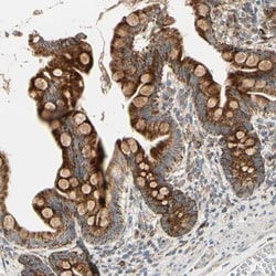 MRPL9 Antibody, Novus Biologicals 0.1mL; Unlabeled:Antibodies, Polyclonal