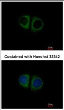 MRPS10 Antibody, Novus Biologicals 0.1 mL | Buy Online | Novus Biologicals | Fisher Scientific