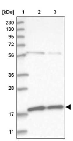 MRPS10 Antibody, Novus Biologicals:Antibodies:Primary Antibodies