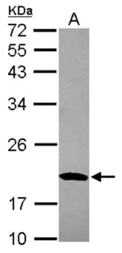 MRPS10 Antibody, Novus Biologicals 0.1 mL | Buy Online | Novus Biologicals | Fisher Scientific
