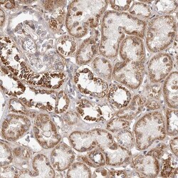 MRPS10 Antibody, Novus Biologicals 0.1mL; Unlabeled:Antibodies, Polyclonal