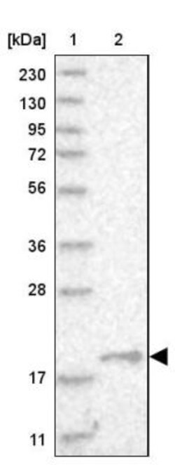MRPS10 Antibody, Novus Biologicals 0.1mL; Unlabeled:Antibodies, Polyclonal