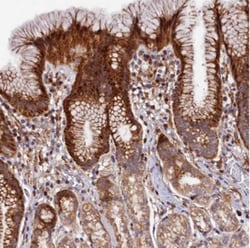 MRPS11 Antibody, Novus Biologicals 0.1mL; Unlabeled:Antibodies, Polyclonal