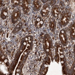 MRPS15 Antibody, Novus Biologicals:Antibodies:Primary Antibodies