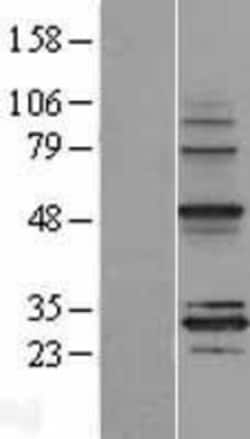 Novus Biologicals™ MRPS18B Overexpression Lysate