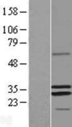 Novus Biologicals&trade;&nbsp;MRPS2 Overexpression Lysate