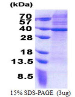 Novus Biologicals&trade;&nbsp;Recombinant Human MRPS2 His Protein