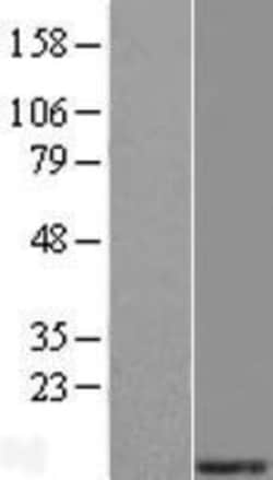 Novus Biologicals&trade;&nbsp;MRPS21 Overexpression Lysate