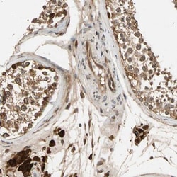 RIN1 Antibody, Novus Biologicals:Antibodies:Primary Antibodies