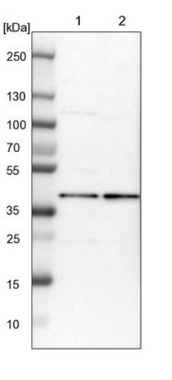 GMPPA Antibody, Novus Biologicals:Antibodies:Primary Antibodies