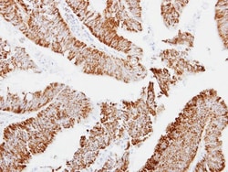 MRPS23 Antibody, Novus Biologicals 0.1mL; Unlabeled:Antibodies, Polyclonal