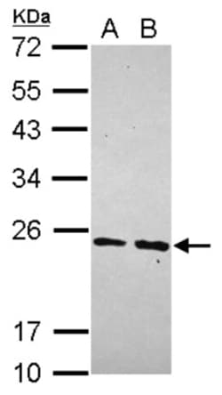 MRPS23 Antibody, Novus Biologicals 0.1mL; Unlabeled:Antibodies, Polyclonal