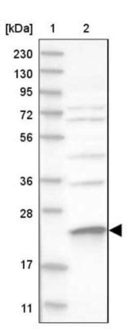 MRPS23 Antibody, Novus Biologicals 25 &mu;L | Buy Online | Novus Biologicals | Fisher Scientific