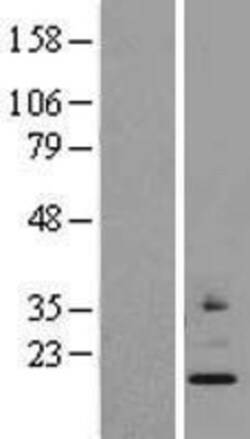 Novus Biologicals™ MRPS24 Overexpression Lysate