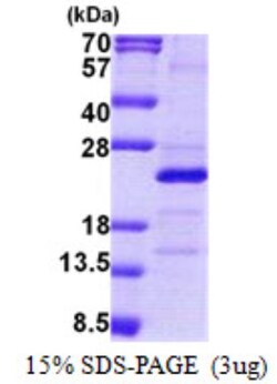 Novus Biologicals&trade;&nbsp;Recombinant Human MRPS25 His Protein