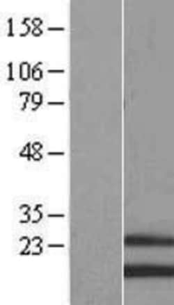 Novus Biologicals™ MRPS28 Overexpression Lysate