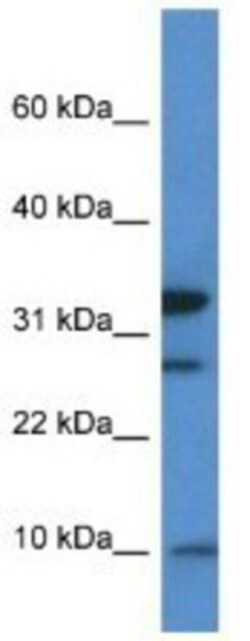 MRPS33 Antibody, Novus Biologicals 100&mu;L; Unlabeled:Antibodies, Polyclonal