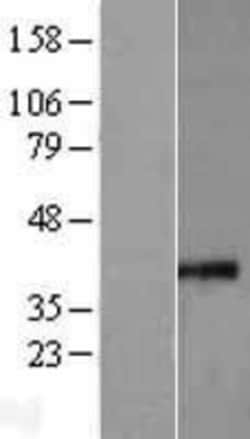 Novus Biologicals&trade;&nbsp;MRPS35 Overexpression Lysate