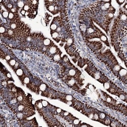 MRPS35 Antibody, Novus Biologicals 0.1mL; Unlabeled:Antibodies, Polyclonal