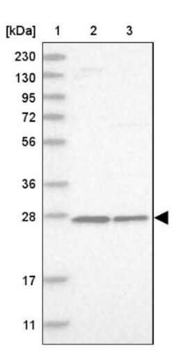 MRPS7 Antibody, Novus Biologicals 0.1mL; Unlabeled:Antibodies, Polyclonal