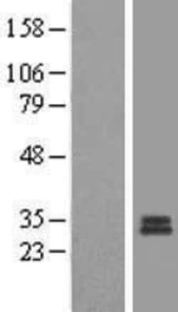 Novus Biologicals™ MRPS7 Overexpression Lysate