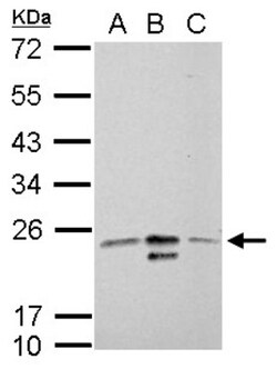 MRRF Antibody, Novus Biologicals 0.1 mL | Buy Online | Novus Biologicals | Fisher Scientific