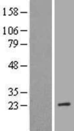 Novus Biologicals™ MRRF Overexpression Lysate