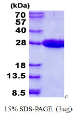 Novus Biologicals&trade;&nbsp;Recombinant Human MRRF His Protein