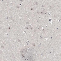 MRTO4 Antibody, Novus Biologicals 0.1mL; Unlabeled:Antibodies, Polyclonal