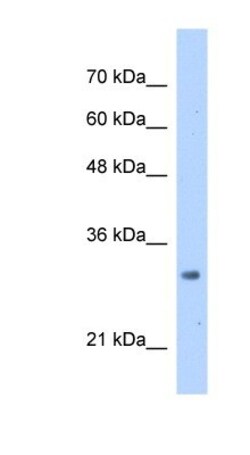 MRTO4 Antibody, Novus Biologicals 100 &mu;L | Buy Online | Novus Biologicals | Fisher Scientific