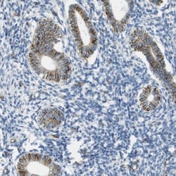 MS4A10 Antibody, Novus Biologicals 0.1mL; Unlabeled:Antibodies, Polyclonal