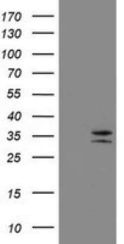 CD20 Antibody (OTI4B4), Novus Biologicals 0.1mL; Unlabeled:Antibodies,