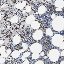 CGR19 Antibody, Novus Biologicals:Antibodies:Primary Antibodies