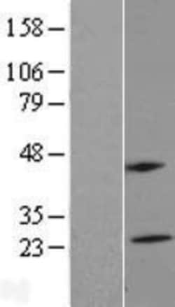 Novus Biologicals&trade;&nbsp;MS4A5 Overexpression Lysate