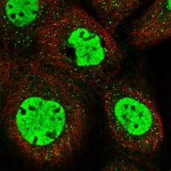 MS4A6A Antibody, Novus Biologicals 0.1mL; Unlabeled:Antibodies, Polyclonal