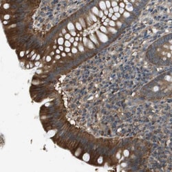 Novus Biologicals Chorein Antibody, Novus Biologicals™