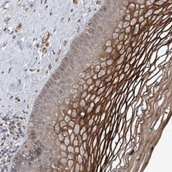 MSANTD2 Antibody, Novus Biologicals:Antibodies:Primary Antibodies