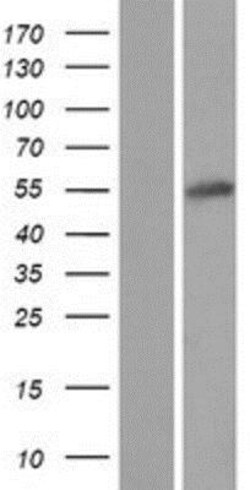 Novus Biologicals&trade;&nbsp;MSANTD2 Overexpression Lysate