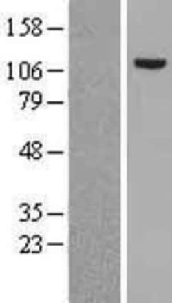 Novus Biologicals™ MSH2 Overexpression Lysate