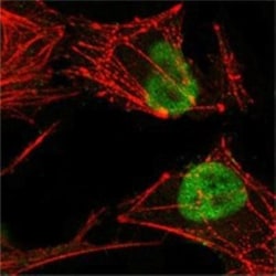 MSH2 Antibody (1B3), Novus Biologicals 0.1mg; Unlabeled:Antibodies, Monoclonal