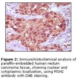 MSH2 Antibody (1B3), Novus Biologicals 0.1mg; Unlabeled:Antibodies, Monoclonal