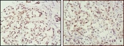 MSH2 Antibody (1B3), Novus Biologicals 0.1mg; Unlabeled:Antibodies, Monoclonal