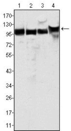 MSH2 Antibody (1B3), Novus Biologicals 0.1mg; Unlabeled:Antibodies, Monoclonal