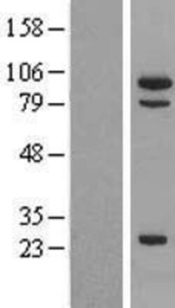 Novus Biologicals&trade;&nbsp;MSH5 Overexpression Lysate