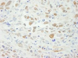 MSH6 Antibody, Novus Biologicals 100 &mu;L | Buy Online | Novus Biologicals | Fisher Scientific