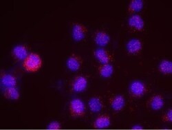MSH6 Antibody, Novus Biologicals 100 &mu;L | Buy Online | Novus Biologicals | Fisher Scientific