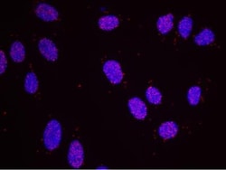 MSH6 Antibody, Novus Biologicals 0.1mg; Unlabeled:Antibodies, Polyclonal