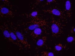 MSH6 Antibody, Novus Biologicals 0.1mg; Unlabeled:Antibodies, Polyclonal